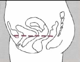 تجربتي مع تمارين كيجل للتضييق - هل تمارين الكيجل تعطي نتائج لتضيق الرحم 11246-Png