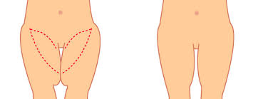 بمكون واحد سوف تتخلصى من الترهلات , ترهلات الفخذين