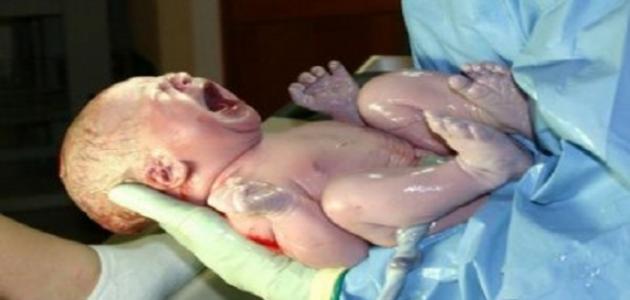 ما هي مخاطر الولاده القيصرية