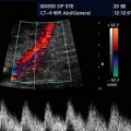 Dailymedicalinfo Doppler Ultrasound 1 اشعة الدوبلر للحامل - متى يطلب الطبيب اشعة الدوبلر اثناء الحمل روان فخري