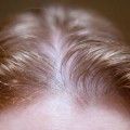 F5Ea3Cd5F5E83Cf40Fd9447Ec569B09D تنبيت الشعر في اسبوع - ملئ الفراغات في الراس بمنتج طبيعي عايشه عمري