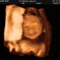 جنين 26 اسبوع 9 الشهر السادس - افعال الجنين الغريبة في الحمل ساحرة القلوب