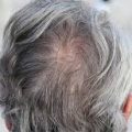 8527 1 روت كير لعلاج الشعر الابيض - علاج كثرة الشعر الابيض طبيعي مشاعر حزينه